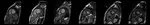 Cardiac MRI